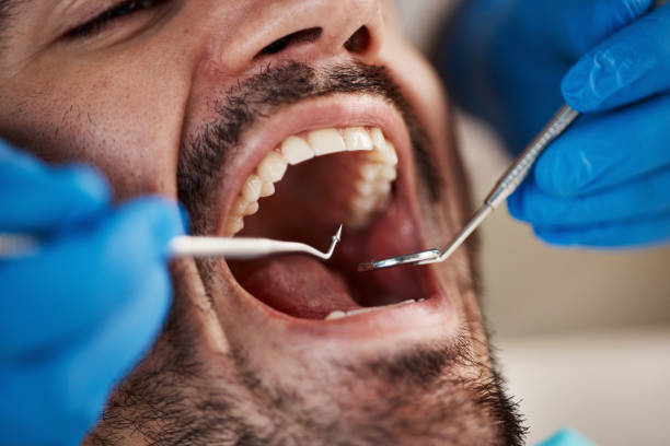Best Emergency Treatment for Dental Infections or Abscesses in Helena Flats, MT